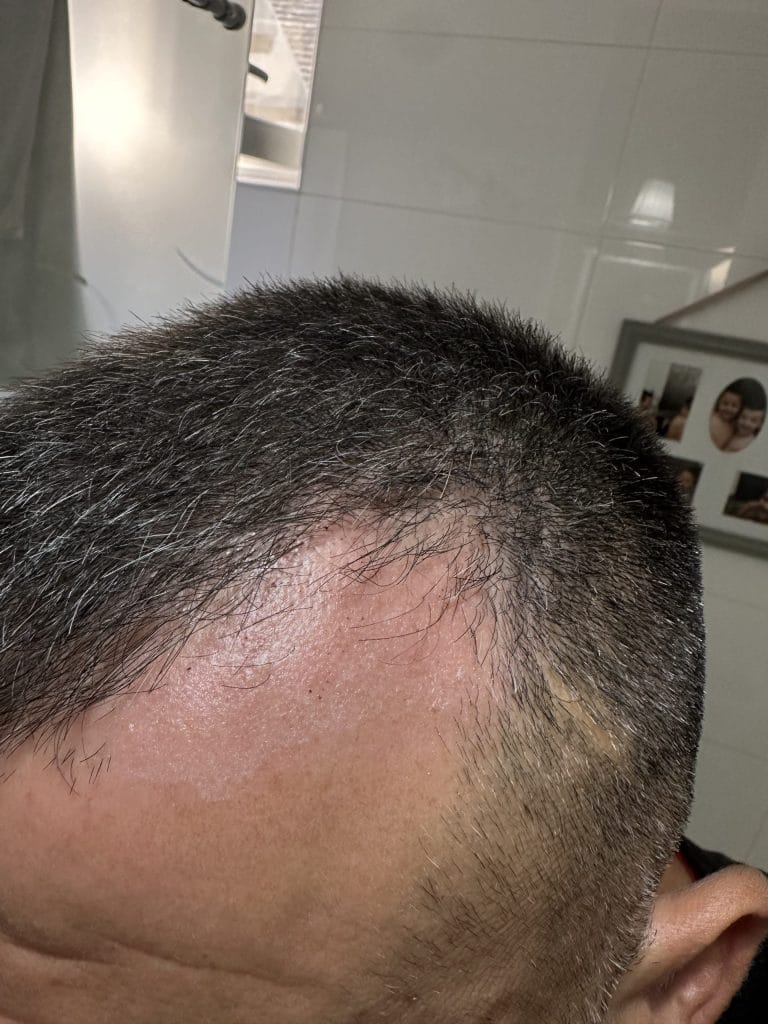 Image #1 from Anoniman