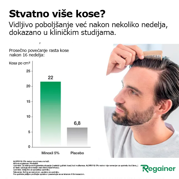 Alopexy 2% - Najbolja minoksidil cena & kvalitet! - Besplatna Dostava! - Slika 2
