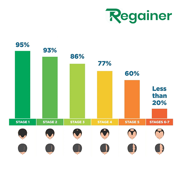 Alopexy 2% - Najbolja minoksidil cena & kvalitet! - Besplatna Dostava! - Slika 6