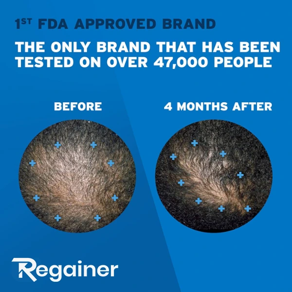 Rogaine 5% Pena - Najprodavaniji Minoksidil na svetu - Besplatna isporuka! - Slika 5