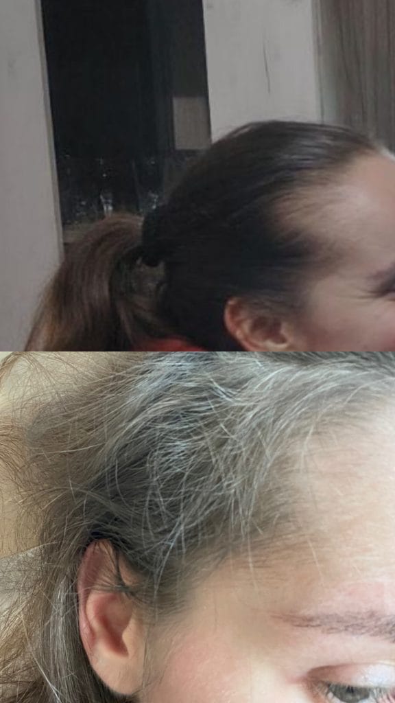 Image #1 from Anonimna