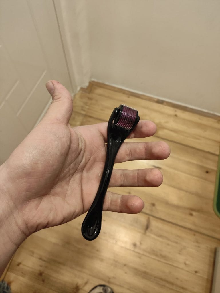 Image #1 from Anoniman